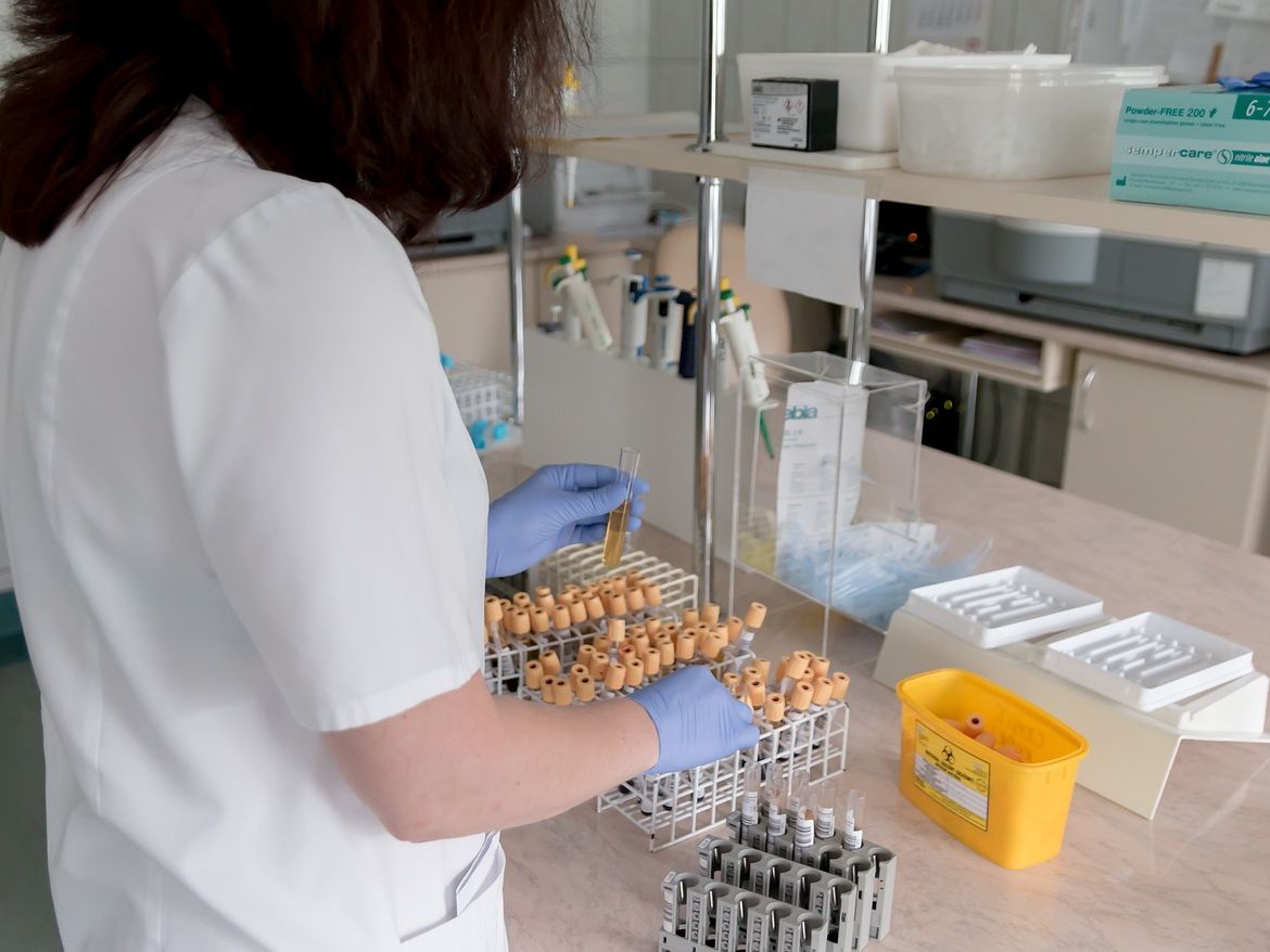 Po jakim czasie test 4 generacji na HIV daje wiarygodny wynik